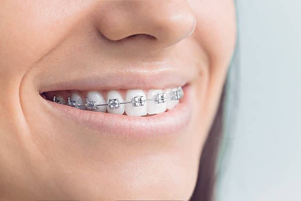 Best Pediatric Dentistry  in Port Byron, NY